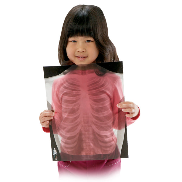 Human X-rays