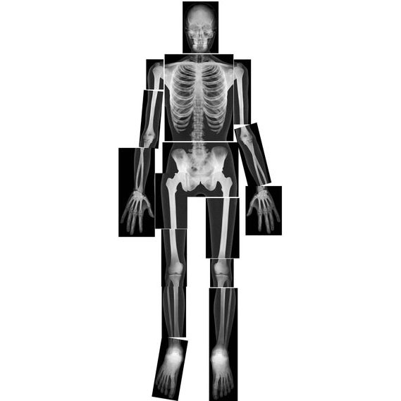 Human X-rays