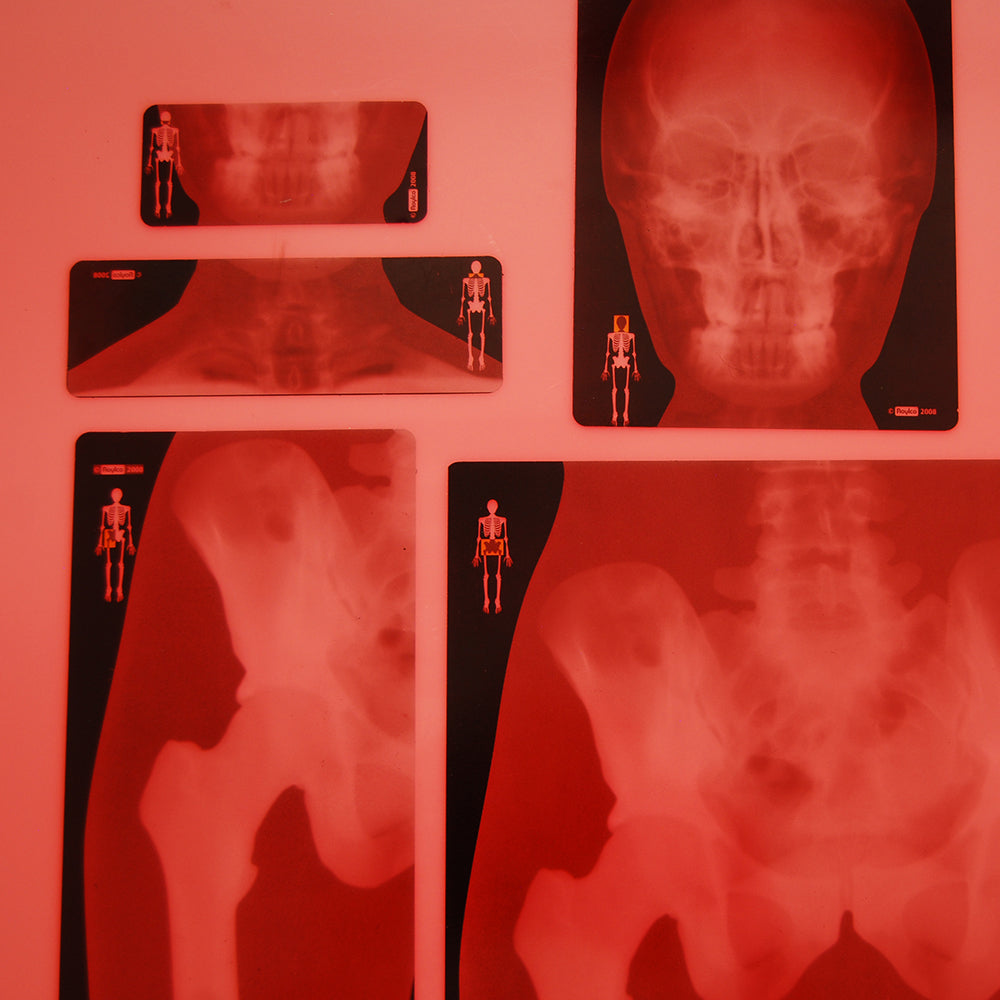 Human X-rays