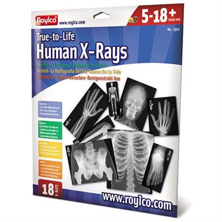 Roylco Human X-rays set featuring 18 realistic black and white skeletal film pieces in a blue and white retail package.