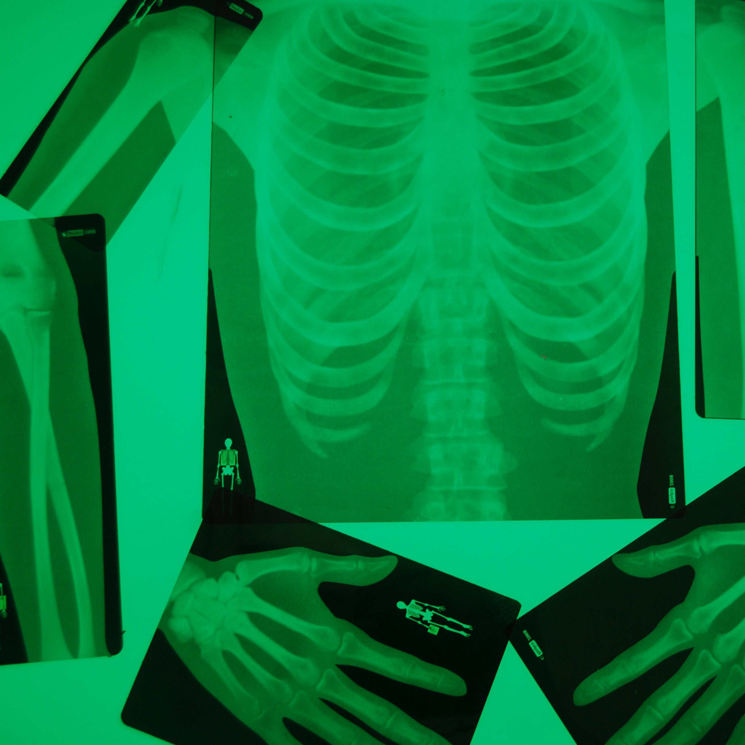 Translucent Roylco human skeleton X-ray sheets illuminated in bright green, featuring detailed rib cage and hand bone anatomy.